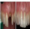DENTIST TREE Image 4