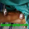 UniCare - Hijamah Center Image 3