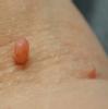 Purna Ayurveda Cosmetic Slimming & Dental Clinic Image 7