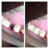 Dhanwanth Dental Care & Implant Center Image 2