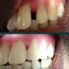 Dhanwanth Dental Care & Implant Center Image 4