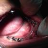 Dhanwanth Dental Care & Implant Center Image 10