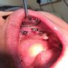Dhanwanth Dental Care & Implant Center Image 6