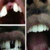 Dhanwanth Dental Care & Implant Center Image 5
