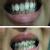 Dhanwanth Dental Care & Implant Center Image 19