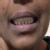 Dhanwanth Dental Care & Implant Center Image 13