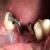 Dhanwanth Dental Care & Implant Center Image 17