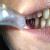 Dhanwanth Dental Care & Implant Center Image 20