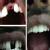 Dhanwanth Dental Care & Implant Center Image 5