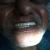Dhanwanth Dental Care & Implant Center Image 9