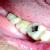 Dhanwanth Dental Care & Implant Center Image 25