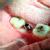 Dhanwanth Dental Care & Implant Center Image 22