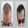 South Delhi Cosmetic Clinic Image 3