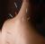 Aura Acupuncture,Hijama,Yoga & Natural Medicine Clinic Image 15
