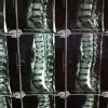Indian Spinal Injuries Center Image 1