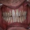 MUSKAN DENTAL CLINIC & IMPLANT CENTRE Image 6