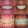 MUSKAN DENTAL CLINIC & IMPLANT CENTRE Image 10