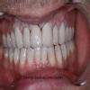MUSKAN DENTAL CLINIC & IMPLANT CENTRE Image 7