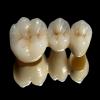 MUSKAN DENTAL CLINIC & IMPLANT CENTRE Image 4