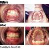 MUSKAN DENTAL CLINIC & IMPLANT CENTRE Image 8