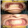 We Relieve Your Pain At Karun'S Dental Clinic Image 2