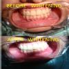 We Relieve Your Pain At Karun'S Dental Clinic Image 5