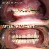 We Relieve Your Pain At Karun'S Dental Clinic Image 1