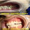 We Relieve Your Pain At Karun'S Dental Clinic Image 4