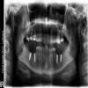thind dental clinic Image 5
