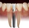 ranjan dental clinic & smile gallerry Image 2