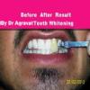 Dr Bharat Agravat Best Cosmetic Dentist Dental Implants Clinic in Ahmedabad India Image 1