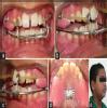 sai dental clinic Image 1