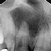 APOLLO DENTAL CLINIC Image 1