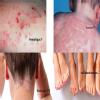 Dr AJ Kanwar's Skin Clinic Image 1